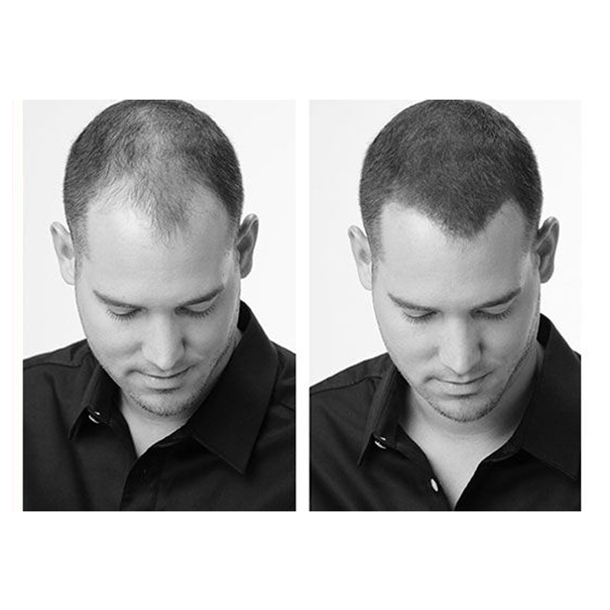 Hair 30 Châtain Clair