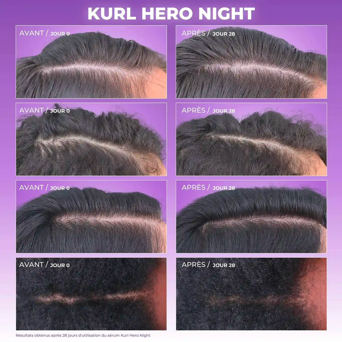 Sérum Kurl Hero Night Les Secrets de Loly 50 ML